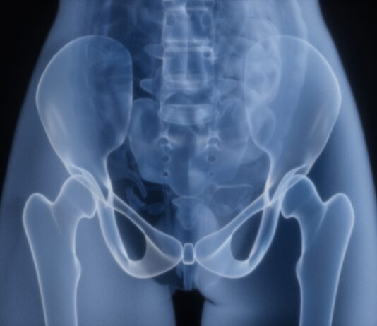 걷기 습관이 무너질 때 우리 몸이 잃어버리는 미세한 균형들 X-ray of a human pelvis and hips