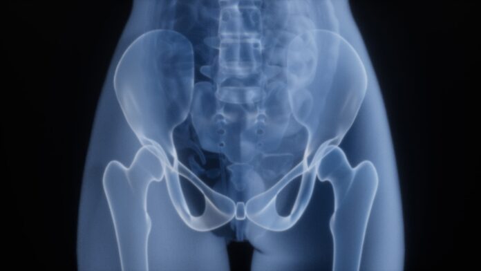 Photo by Rohit Choudhari X-ray of a human pelvis and hips